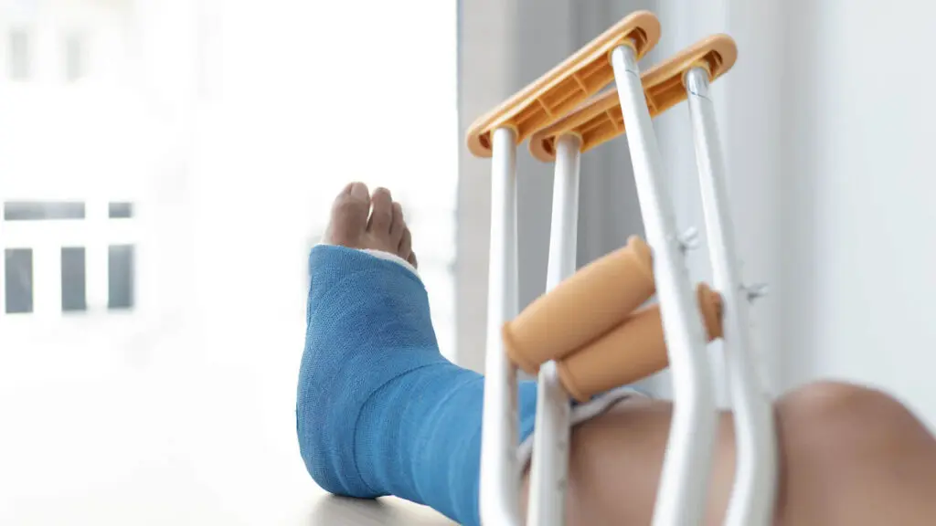 A blue cast on a foot, beige and silver crutches leaning against it.