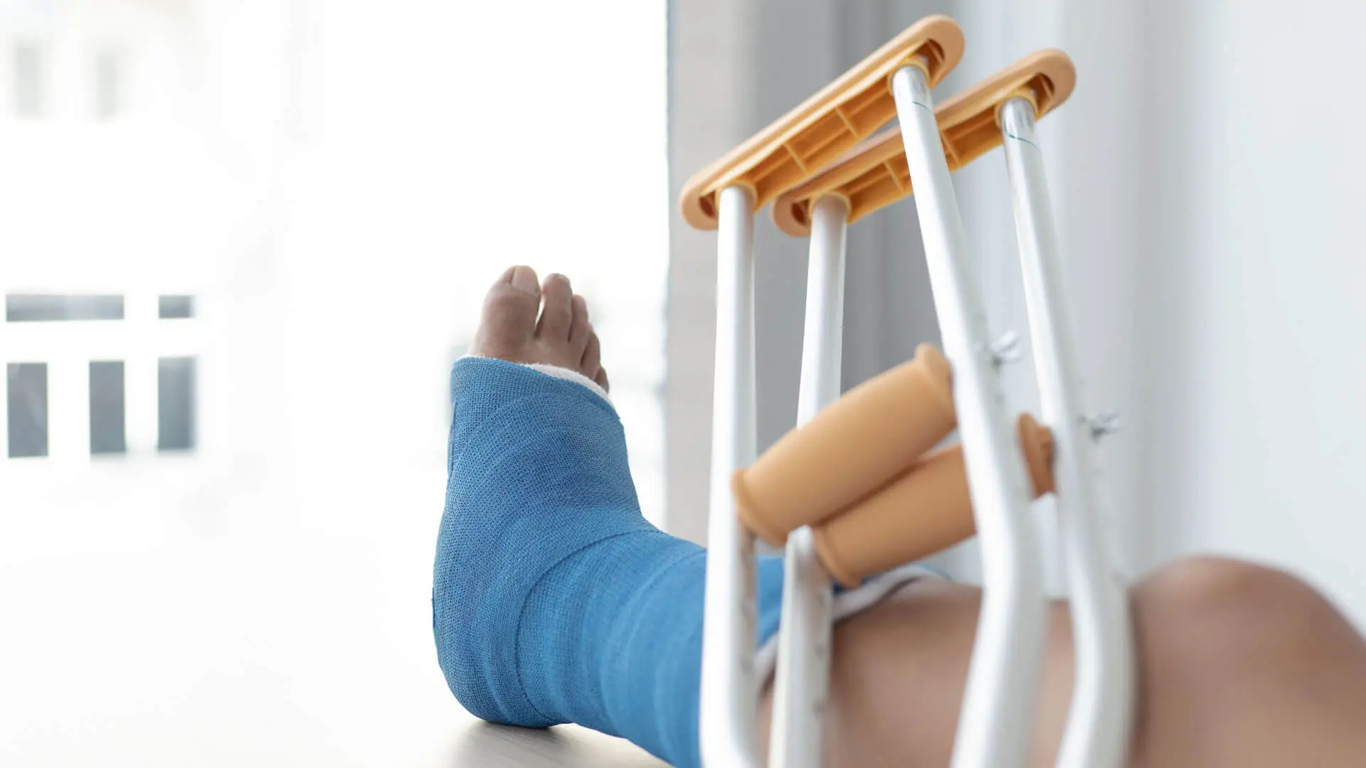 A blue cast on a foot, beige and silver crutches leaning against it.