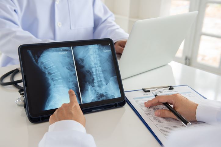 Legal Aid for Spinal Cord Injuries: How Law Firms Can Make a Difference