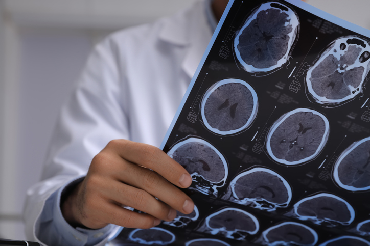Brain Injuries: Winter Sports and Legal Support
